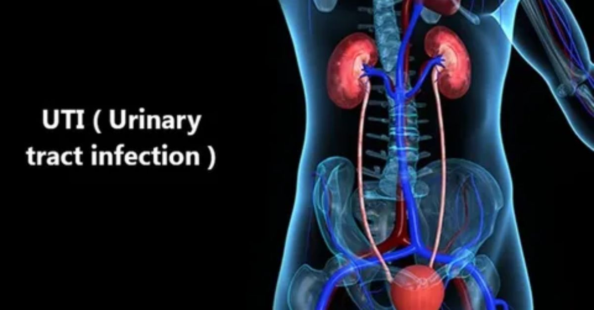 UTI Dyer and Drinking Water Benefits